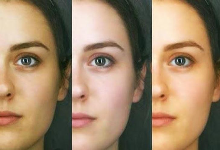 25 وصفة منزلية للتخلص من إسمرار البشرة 25 وصفة منزلية للتخلص من إسمرار البشرة