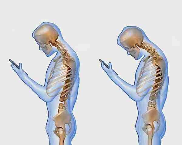 دراسة، مراجعة الرسائل النصية علي هاتفك المحمول تسبب ألام الظهر والرقبة دراسة، مراجعة الرسائل النصية علي هاتفك المحمول تسبب ألام الظهر والرقبة
