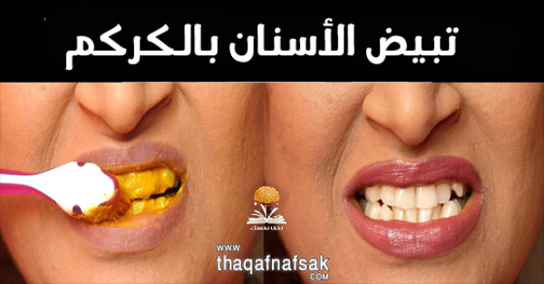 خلطات زيادة بياض الأسنان بالكركم خلطات زيادة بياض الأسنان بالكركم