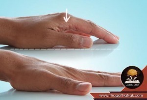 تمارين اليد والأصابع بالصور تمارين اليد والأصابع بالصور