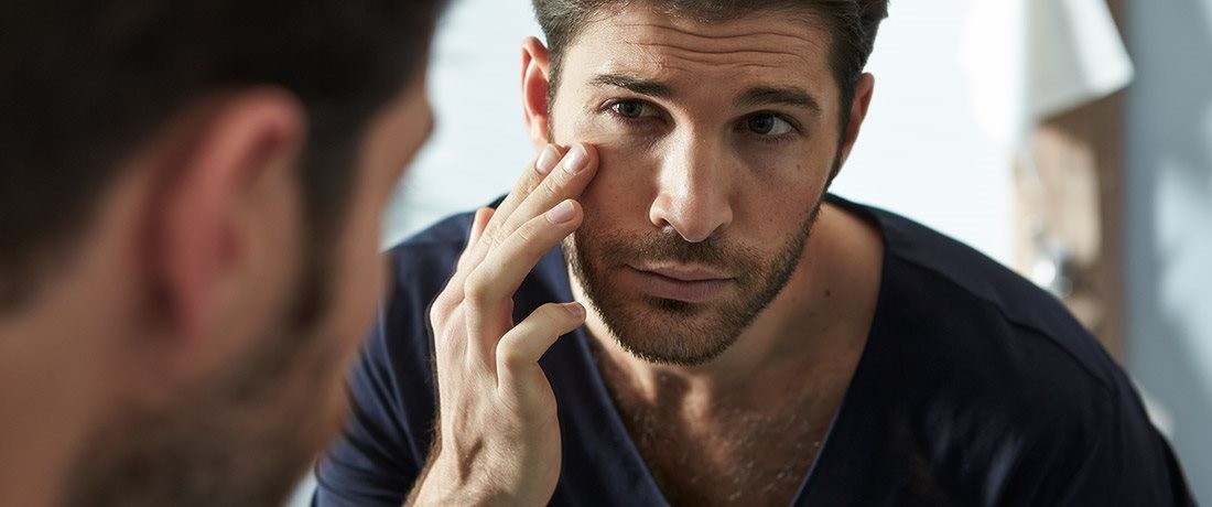 علاج الهالات السوداء لدى الرجال