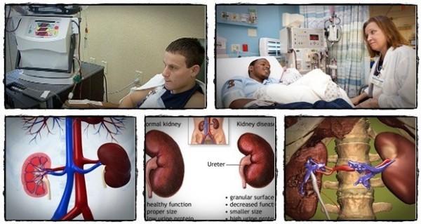 ما هى العلامات الدالة على تضرر الكلى ؟