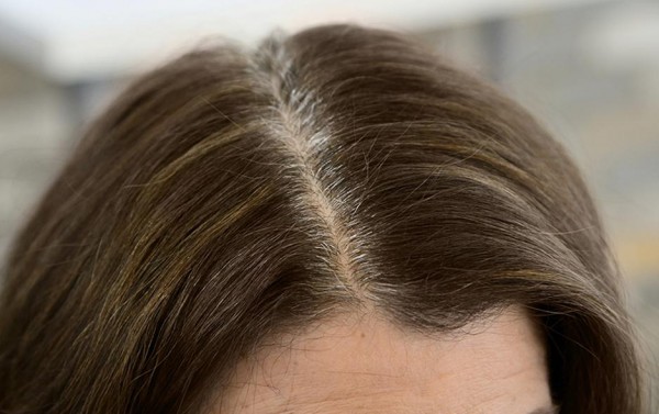 5 طرق طبيعية لتغطية الشعر الأبيض بدون كيماويات 5 طرق طبيعية لتغطية الشعر الأبيض بدون كيماويات