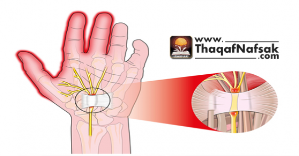 أسباب ألم اليد اليسرى و الشعور بثقل بها