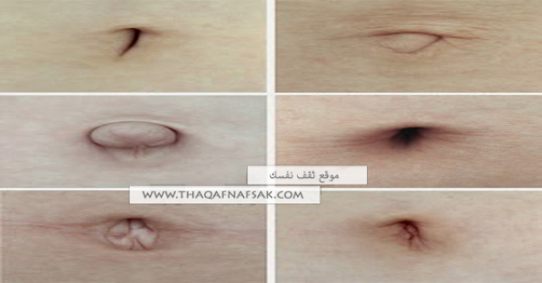 تعرف علي حقائق وأنواع سُرة البطن