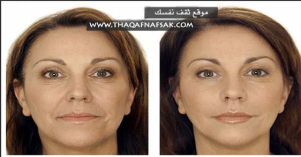 علاج التجاعيد بمجموعة كريمات منزلية الصنع علاج التجاعيد بمجموعة كريمات منزلية الصنع