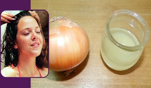 عصير البصل لزيادة كثافة الشعر وعلاج التساقط