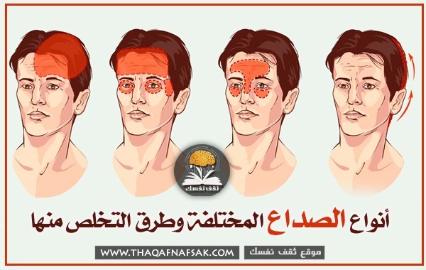 أنواع الصداع وطرق التخلص منها أنواع الصداع وطرق التخلص منها
