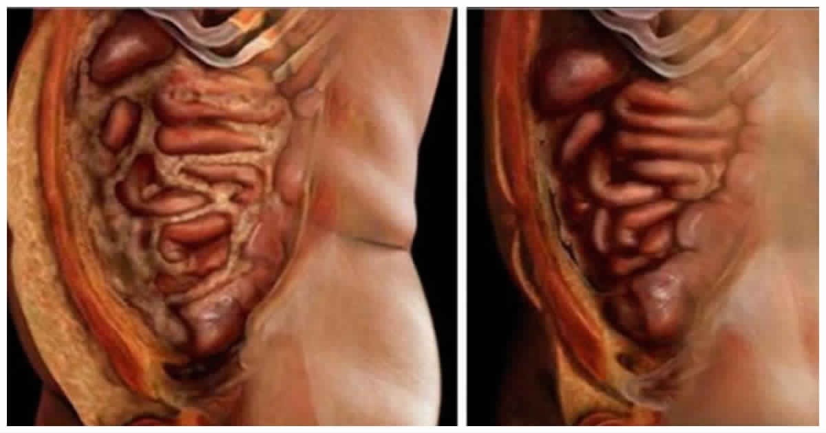 أنواع الدهون، وهل كل الدهون ضارة ؟