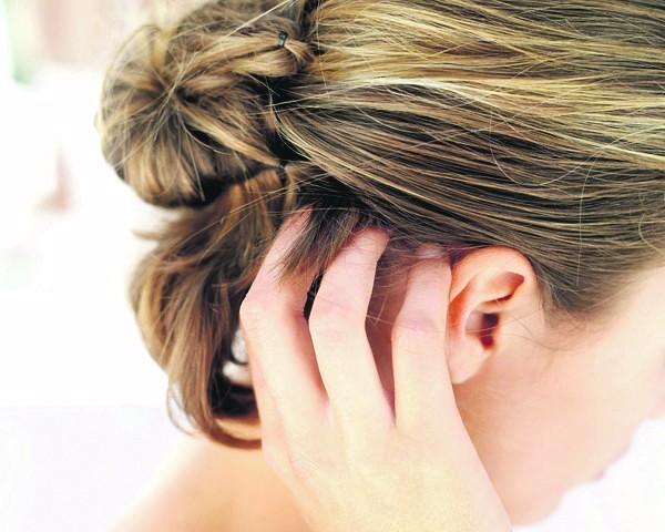 علاج الحكة في فروة الرأس بخلطات من الطب البديل علاج الحكة في فروة الرأس بخلطات من الطب البديل