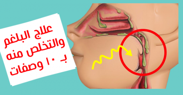 بدون أدوية ١٠ وصفات عالج بها نفسك من البلغم بدون أدوية ١٠ وصفات عالج بها نفسك من البلغم