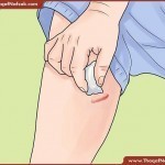 ندبات و بثور الساقين طرق علاجها طبيعيا بالصور