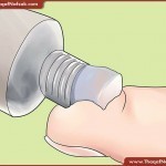 ندبات و بثور الساقين طرق علاجها طبيعيا بالصور