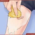 ندبات و بثور الساقين طرق علاجها طبيعيا بالصور