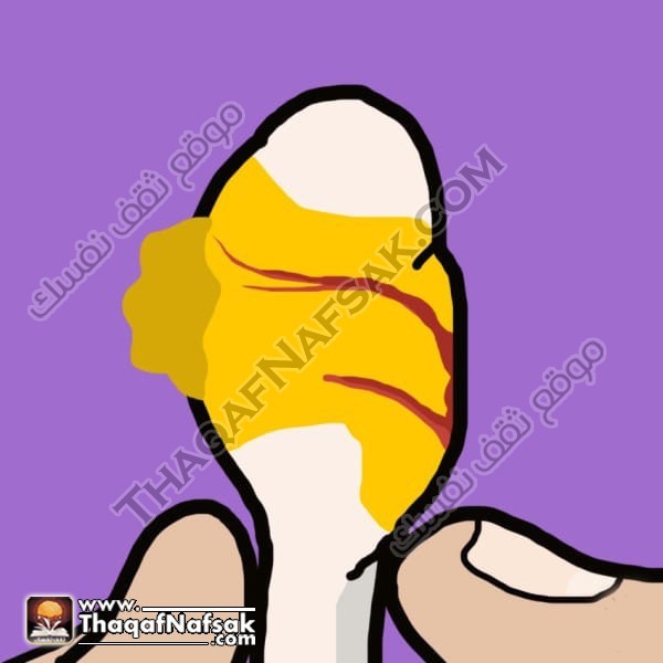 ماذا يقول شمع الأذن عن صحتك ؟ صور ماذا يقول شمع الأذن عن صحتك ؟ صور