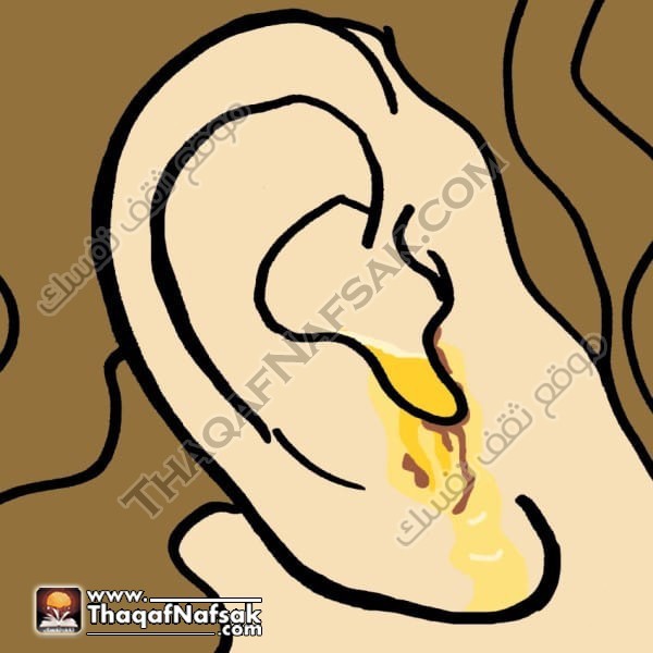 ماذا يقول شمع الأذن عن صحتك ؟ صور ماذا يقول شمع الأذن عن صحتك ؟ صور