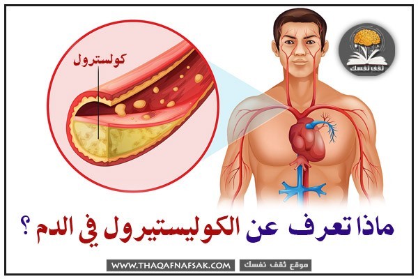 اعرف اكثر عن الكوليستيرول في الدم اعرف اكثر عن الكوليستيرول في الدم
