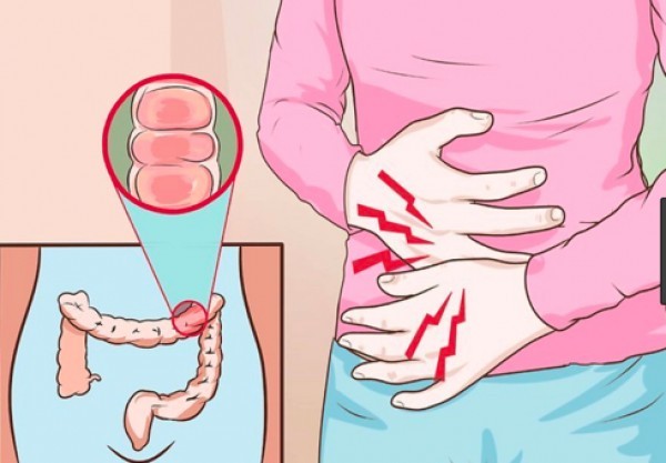 تهدئة وعلاج إلتهاب القولون ٢٤ وصفه ستفيد القولون