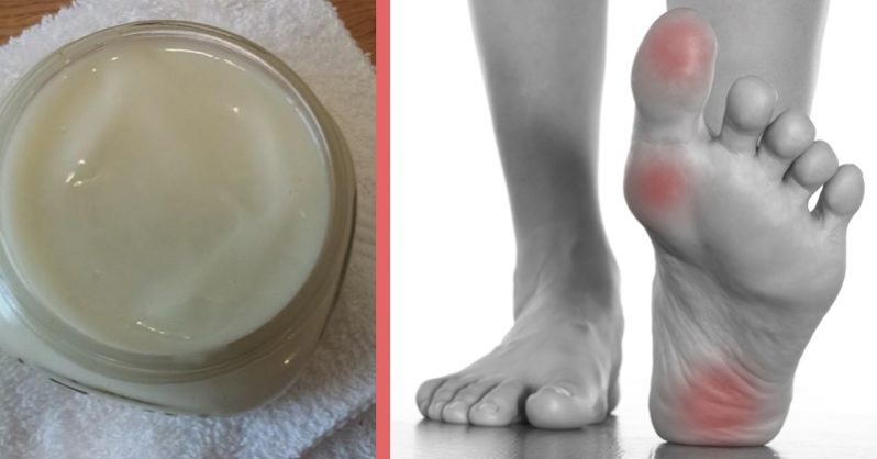 لوشن المغنسيوم المنزلي لتخفيف الألم