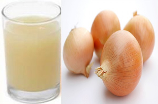 علاج القشرة بوصفة عصير البصل