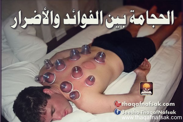 الحجامة و فوائدها للصحة و لعلاج العديد من الأمراض الحجامة و فوائدها للصحة و لعلاج العديد من الأمراض