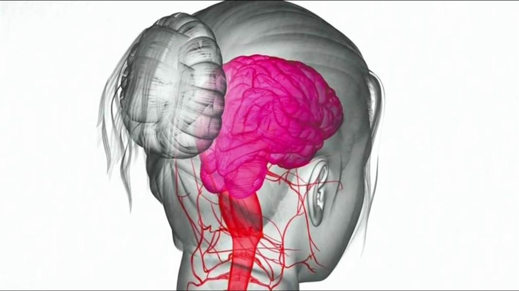 أسباب وعلاج الصداع النصفي طبيعيا وماهي أعراضه