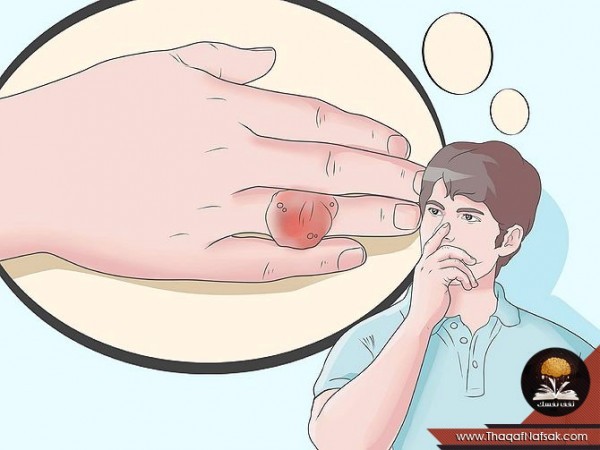 كيف تقلل حمض اليوريك في الدم للحماية من مرض النقرس و علاجه كيف تقلل حمض اليوريك في الدم للحماية من مرض النقرس و علاجه