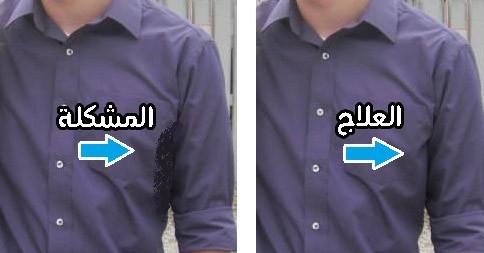 اعاني من مشكلة التعرق الزائد إليك١٠ علاجات منزلية تقضي عليه