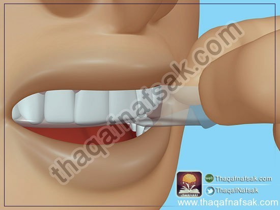 بالصور كيف تبيض أسنانك في المنزل ؟