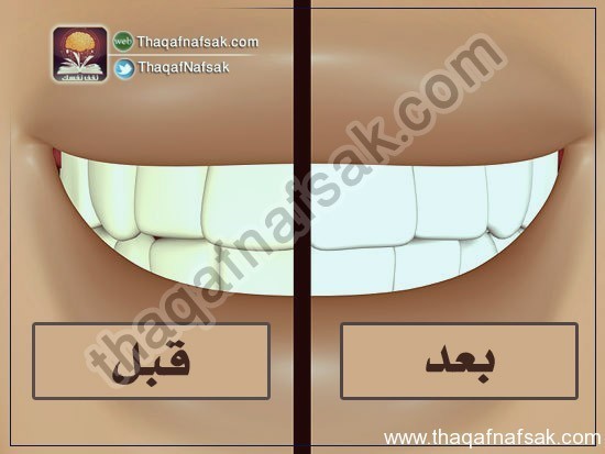 بالصور كيف تبيض أسنانك في المنزل ؟ بالصور كيف تبيض أسنانك في المنزل ؟