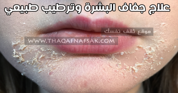 علاج جفاف البشرة ١٨ وصفة ستمنحك بشرة رطبة علاج جفاف البشرة ١٨ وصفة ستمنحك بشرة رطبة