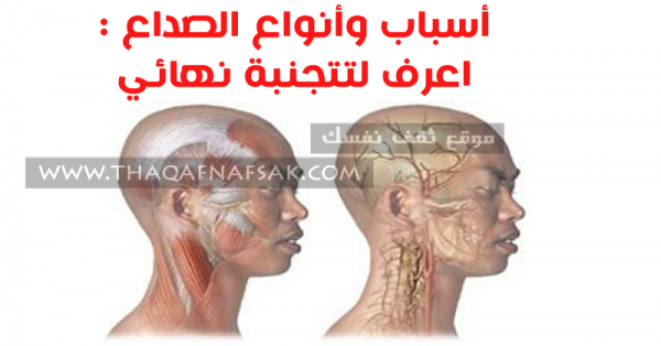 أسباب الصداع وأنواع الصداع أعرفها للتتجنبه نهائي أسباب الصداع وأنواع الصداع أعرفها للتتجنبه نهائي