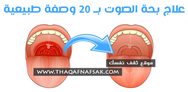 علاج بحة الصوت بـ ٢٠ وصفة مفيدة للجهاز التنفسي كله