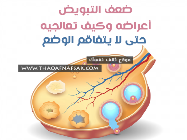 ضعف التبويض أعراضه، أسبابه وطرق علاجه فوراً حتى لا يتفاقم الوضع ضعف التبويض أعراضه، أسبابه وطرق علاجه فوراً حتى لا يتفاقم الوضع