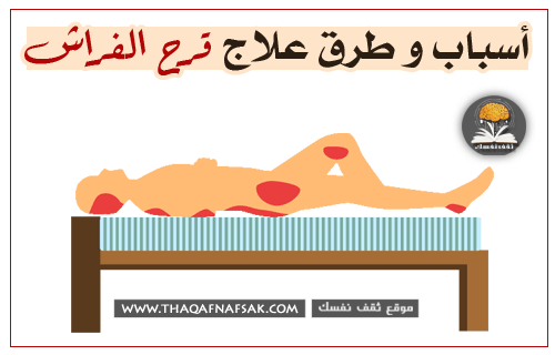 ما سبب قرح الفراش؟ وكيفية العلاج والوقاية منها ما سبب قرح الفراش؟ وكيفية العلاج والوقاية منها