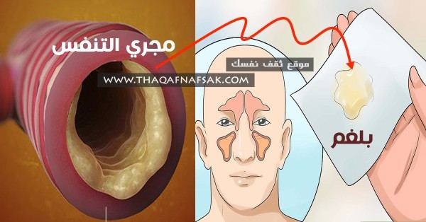 علاج البلغم بوصفات سهلة التحضير