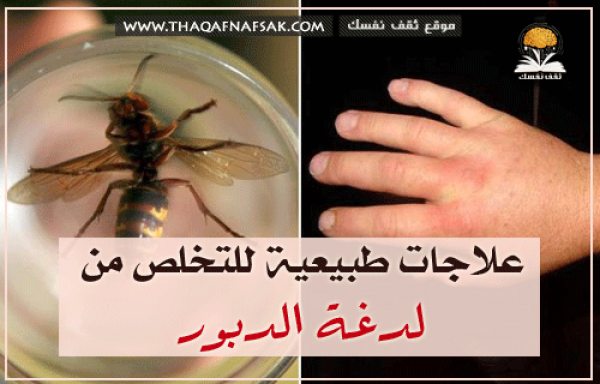 علاج لدغة الدبور بوصفات منزلية سريعة توقف الألم
