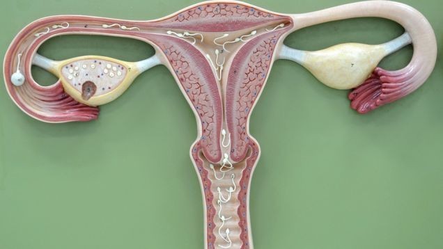 علاجات طبيعية لتكيس المبايض كيف تعالجي متلازمة تكيس المبايض بنفسك