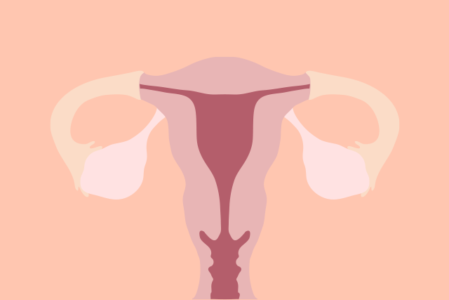 ماهي أعراض تكيس المبايض ؟