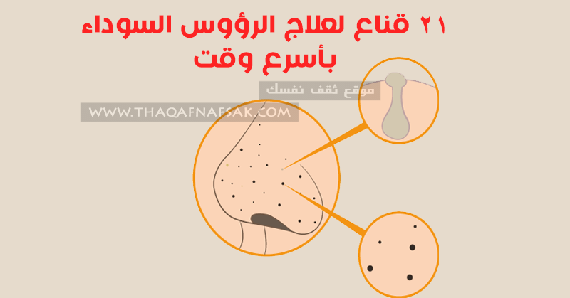 علاج الرؤوس السوداء ٢١ قناع ننصحك به