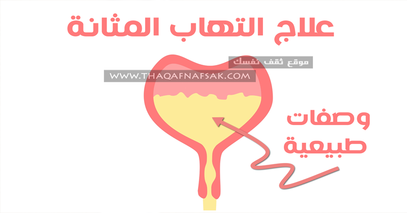 علاج التهاب المثانة بطرق طبيعية سهلة