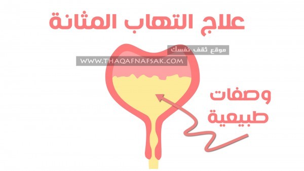 علاج التهاب المثانة بطرق طبيعية سهلة علاج التهاب المثانة بطرق طبيعية سهلة