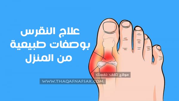 علاج النقرس بالطرق الطبيعية في المنزل علاج النقرس بالطرق الطبيعية في المنزل