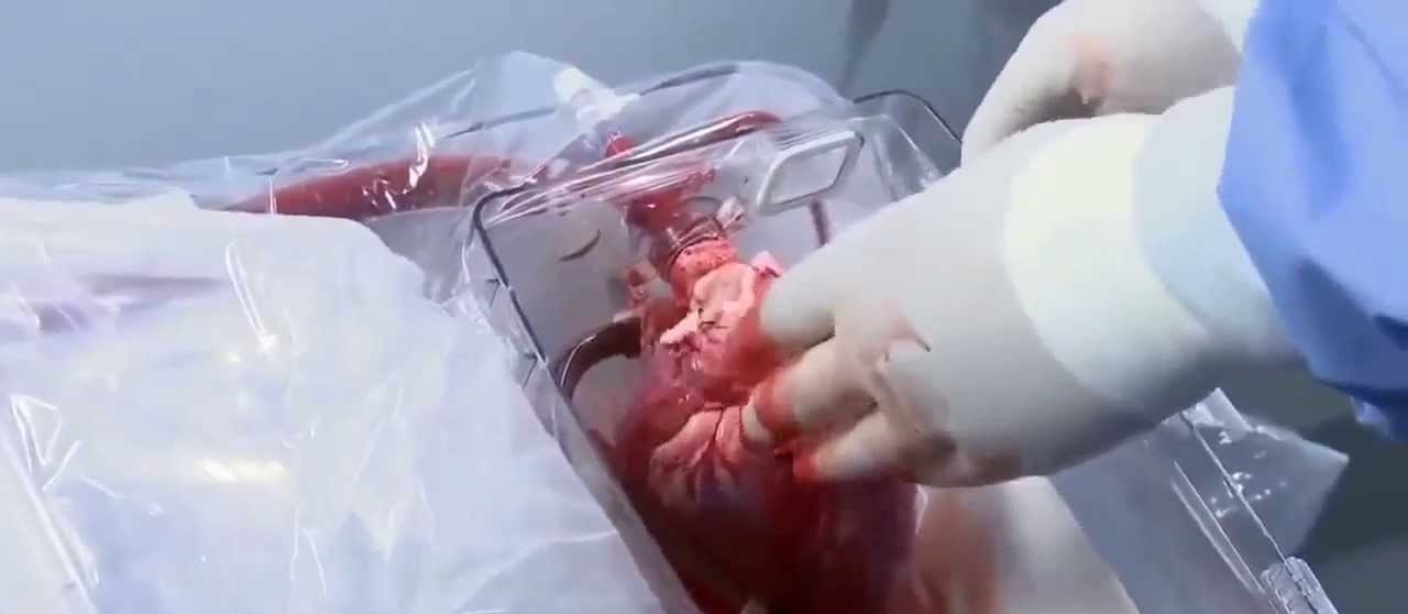 هل يستطيع القلب التفكير؟! يبدو بأن الجواب قد أصبح نعم!