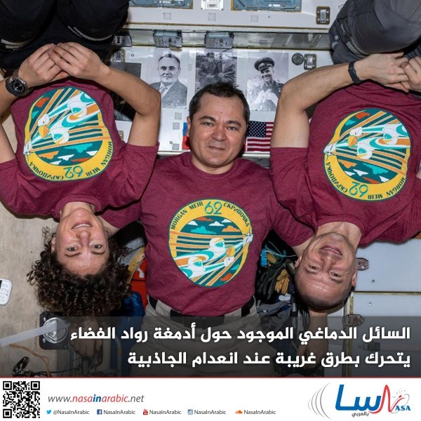 السائل الدماغي الموجود حول أدمغة رواد الفضاء يتحرك بطرق غريبة عند انعدام الجاذبية