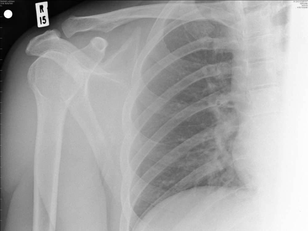 8 طفرات وراثية ستمنحك قدرات شبه خارقة 8 طفرات وراثية ستمنحك قدرات شبه خارقة