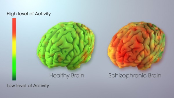 تعرف على اضطراب ثنائي القطب الذي يجمع بين الاكتئاب وجنون الفرح تعرف على اضطراب ثنائي القطب الذي يجمع بين الاكتئاب وجنون الفرح