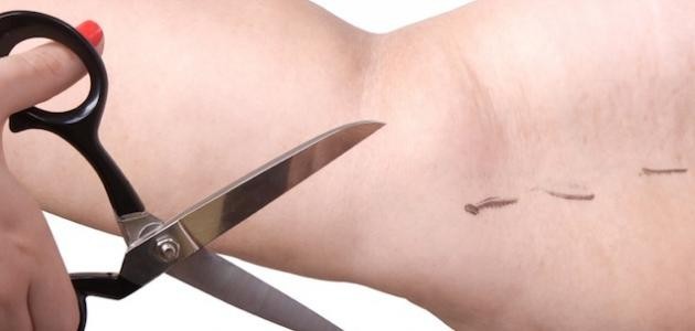 طريقة لتخفيف الزنود