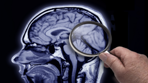 ماذا يحدث في الدماغ عندما نتخيل المستقبل؟