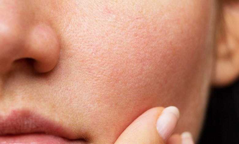 غلق مسام الوجه نهائياً